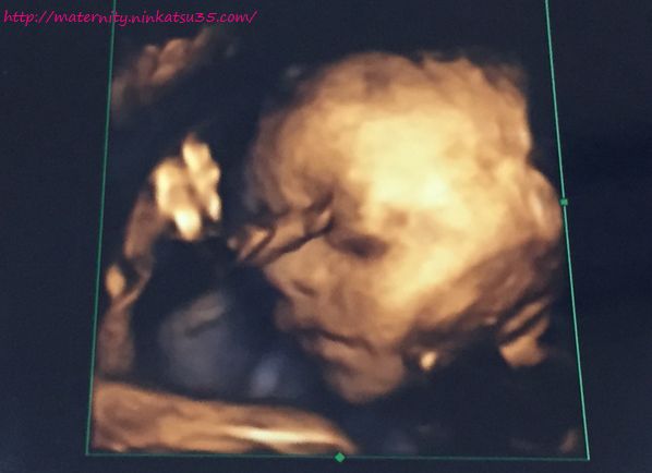 妊娠27週3D顔写真